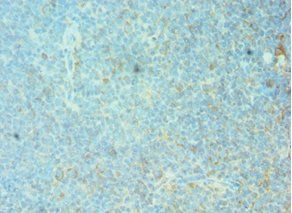 FOSL1 Antibody