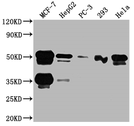 FOXA1 Antibody
