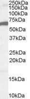 FOXA2/HNF3B Antibody