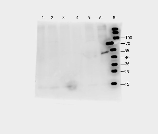 FOXC1 Rabbit Polyclonal Antibody
