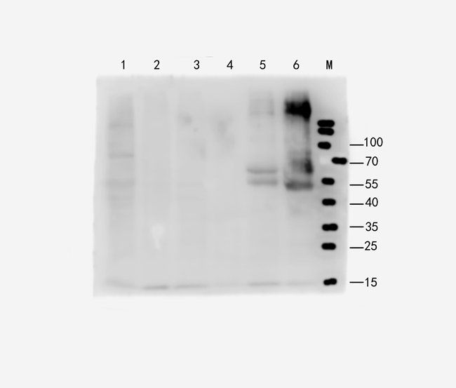 FOXC1 Rabbit Polyclonal Antibody