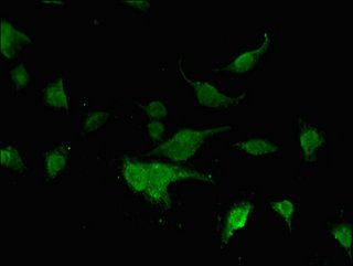 FOXK1 Antibody