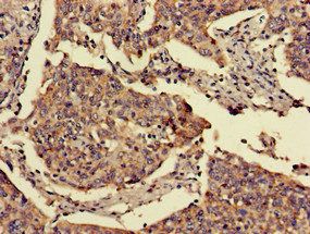 FOXN1 Antibody