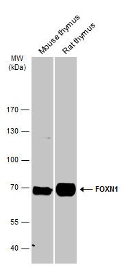 forkhead box N1 Antibody