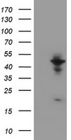 FOXP1 Antibody