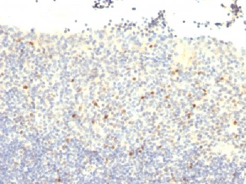 PAX2 Antibody