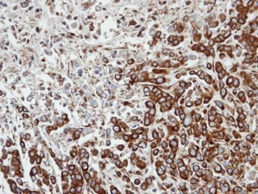FPGT Rabbit Polyclonal Antibody