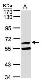 FPGT Rabbit Polyclonal Antibody