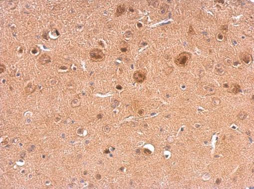 NCS1 Rabbit Polyclonal Antibody