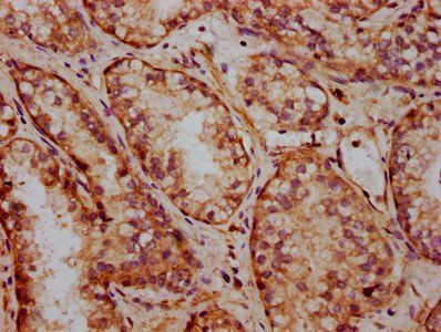FRMD7 Antibody