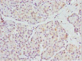 FRZB Antibody