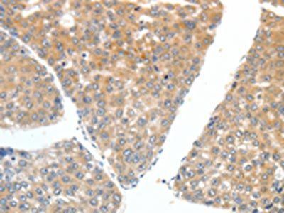 FSHR Antibody