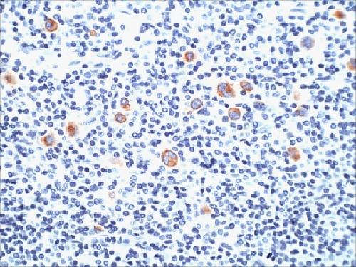 FUT4 Antibody