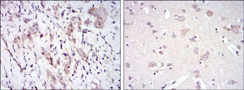 FYN Antibody