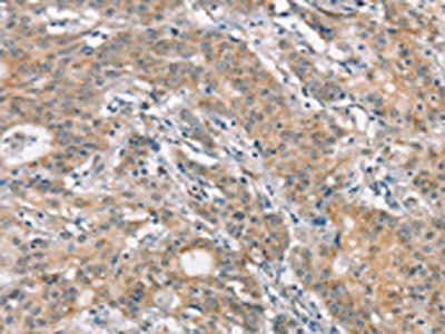 FZD1 Antibody