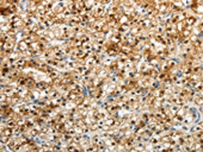FZD2 Antibody