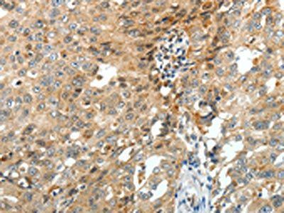 FZD3 Antibody