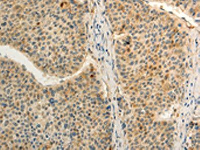 FZD8 Antibody