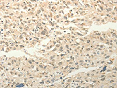 FZD8 Antibody