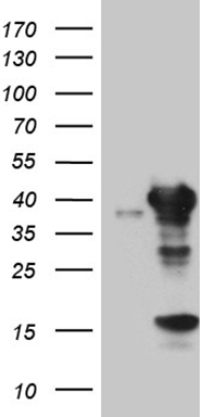 G protein alpha S Antibody