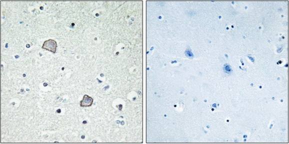 EDG2 Antibody