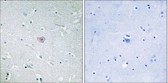 PE2R3 Antibody