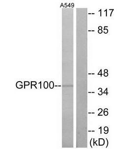 GPR100 Antibody
