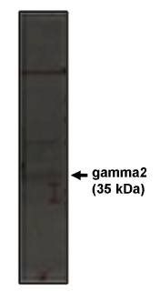 Rabbit Human Calcium Channel Antibody
