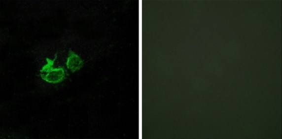 GHRHR Antibody