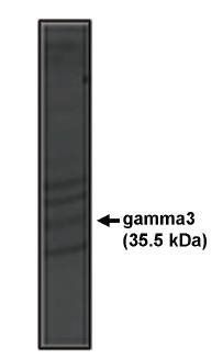 Rabbit Human Calcium Channel Antibody