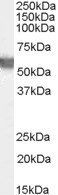 G6PD (aa 308 - 320) Antibody