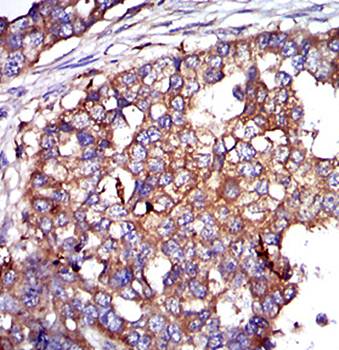 G6PD Antibody