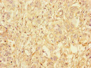 GAA Antibody