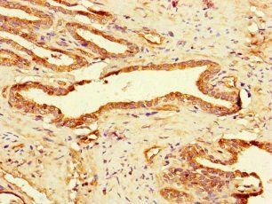 GAA Antibody