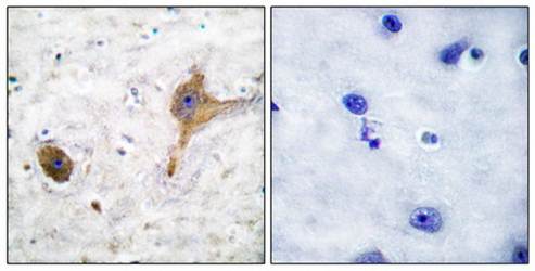 GABA-B Receptor Antibody