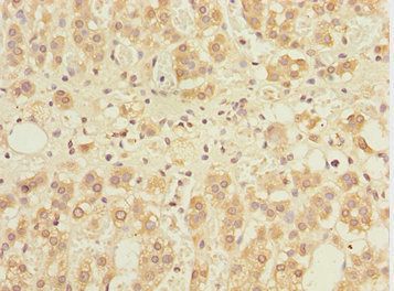 GABARAPL1 Antibody