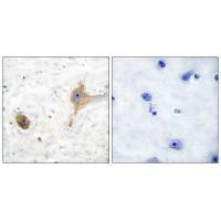 GABBR1 Antibody