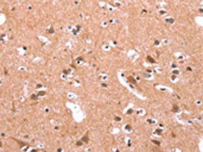 GABRA1 Antibody