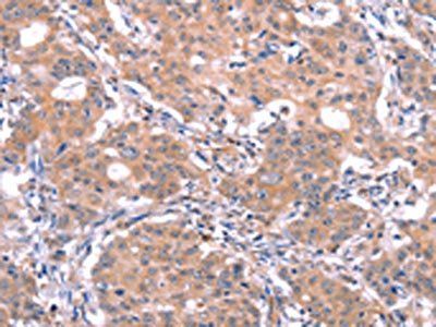 GABRA1 Antibody