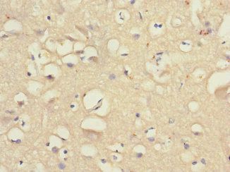 GABRA4 Antibody