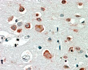 GABRA4 Antibody