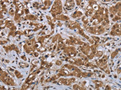 GABRB1 Antibody