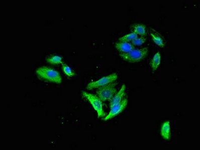 GABRB3 Antibody