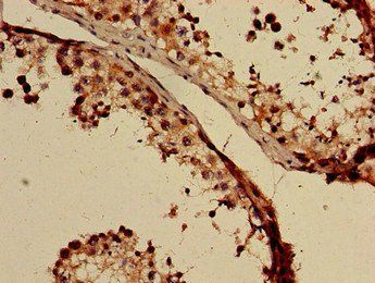 GABRB3 Antibody