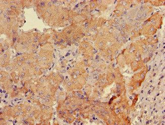 GABRB3 Antibody
