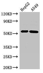 GABRB3 Antibody