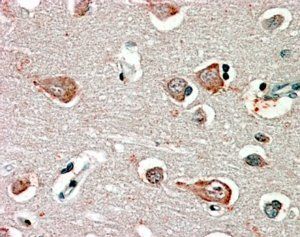 GABRB3 Antibody