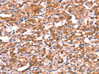 GABRG2 Antibody