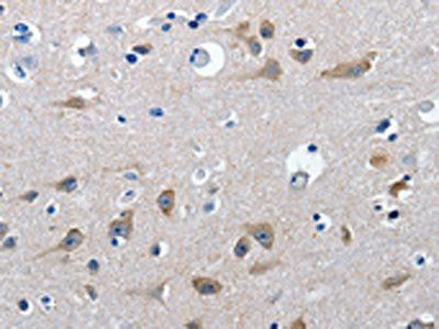 GAD2 Antibody