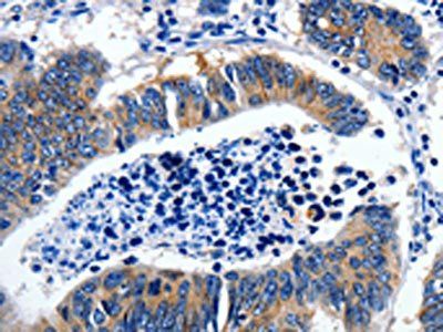 GAD2 Antibody